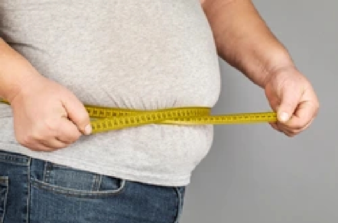 Obesity